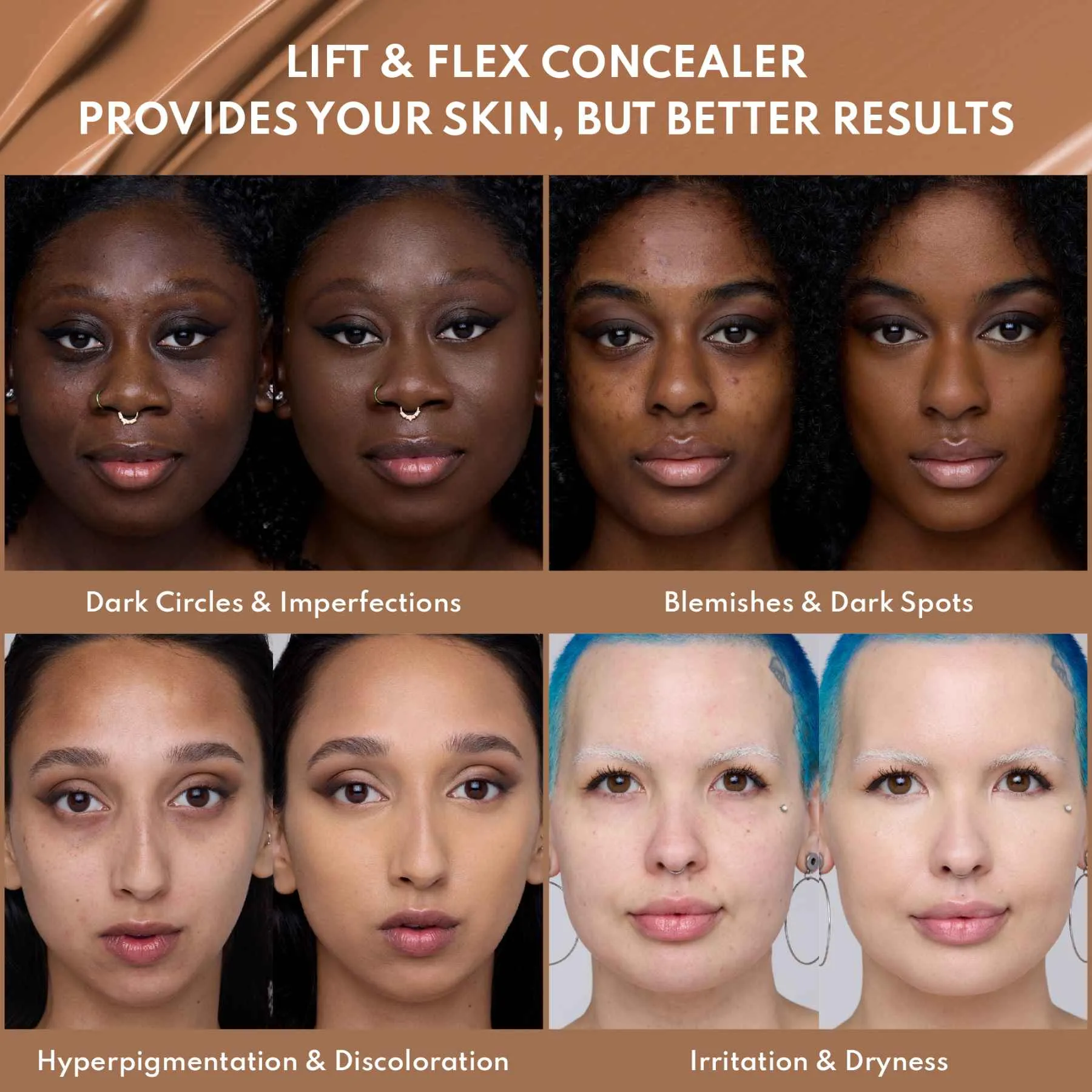 YUMMY SKIN LIFT & FLEX CONCEALER